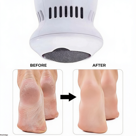USB rechargeable electric callus remover for foot care