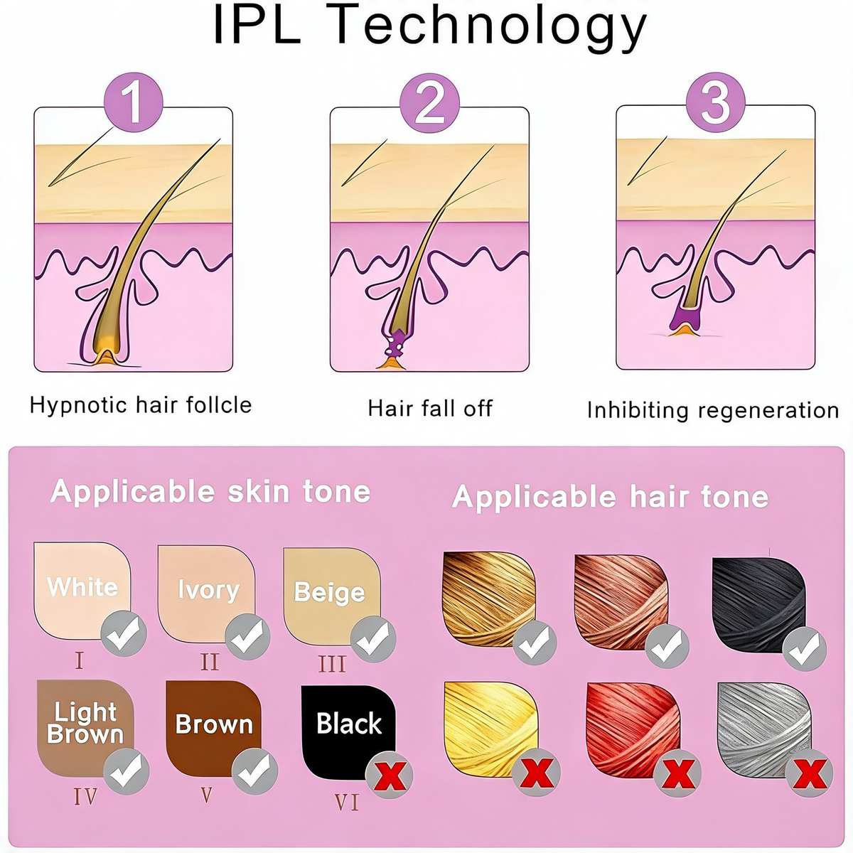 IPL hair removal device with five intensity settings