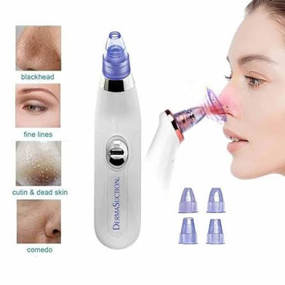 DermaPure Pro 5-Level Electric Pore Vacuum Blackhead Remover
