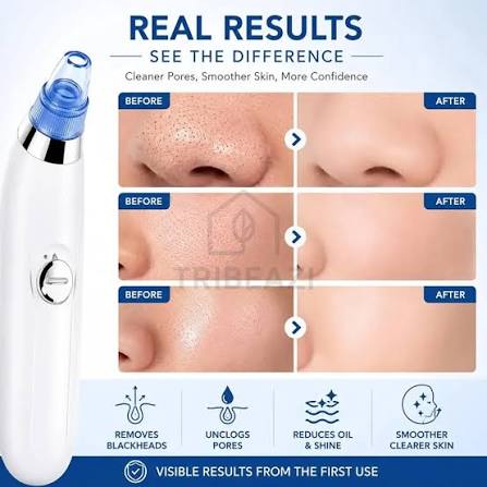 DermaPure Pro 5-Level Electric Pore Vacuum Blackhead Remover